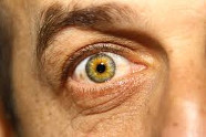 Comment Soigner Les Yeux Secs?