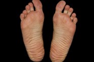 Comment Soigner Ses Pieds?