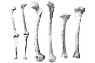 Comment Soigner Les Rhumatismes?